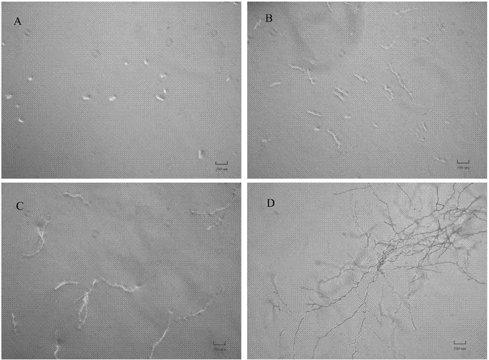 足球赌注软件APP